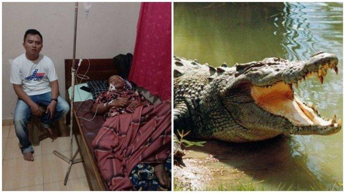 Kondisi Jariyanto setelah digigit buaya saat cari ikan