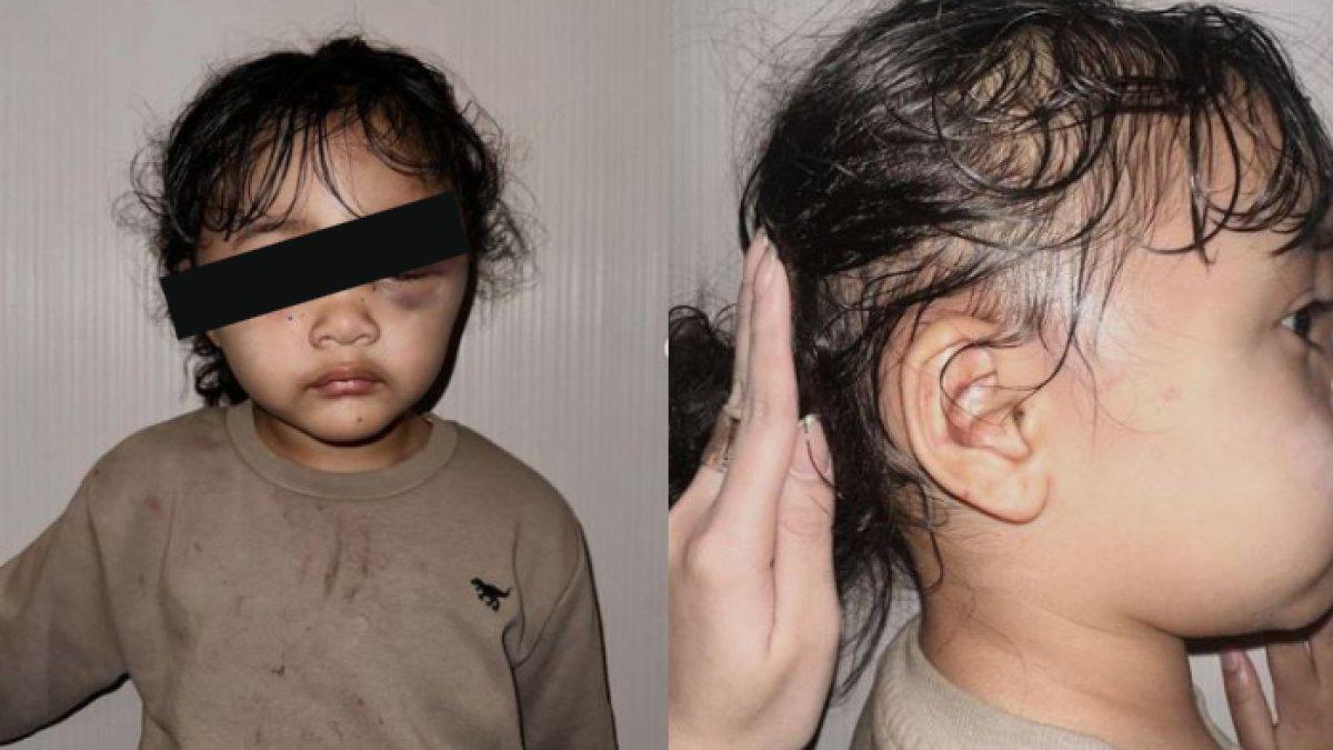 Kondisi anak Aghnia Punjabi usai disiksa pengasuh