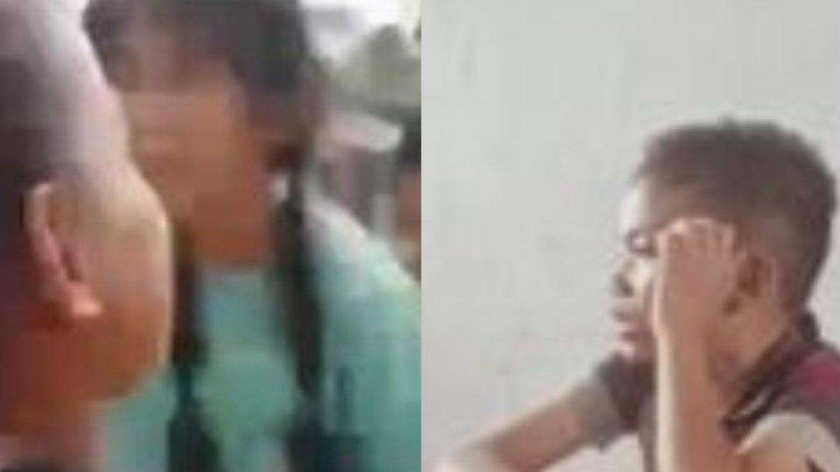 Kondisi bocah dianiaya teman sekolah di Simalungun