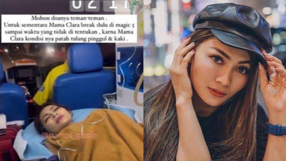 Delia Yasmine, kecelakaan di Tol Jagorawi, langsung tindakan 4 operasi.