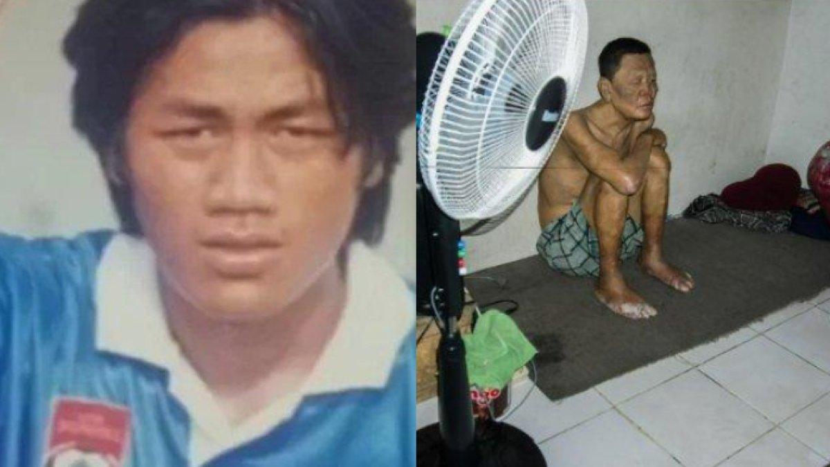 Legenda PSIS Semarang, Budiono Sutikno kini hidup di rusun dengan kondisi sakit diabetes, hidung pecah, hingga katarak