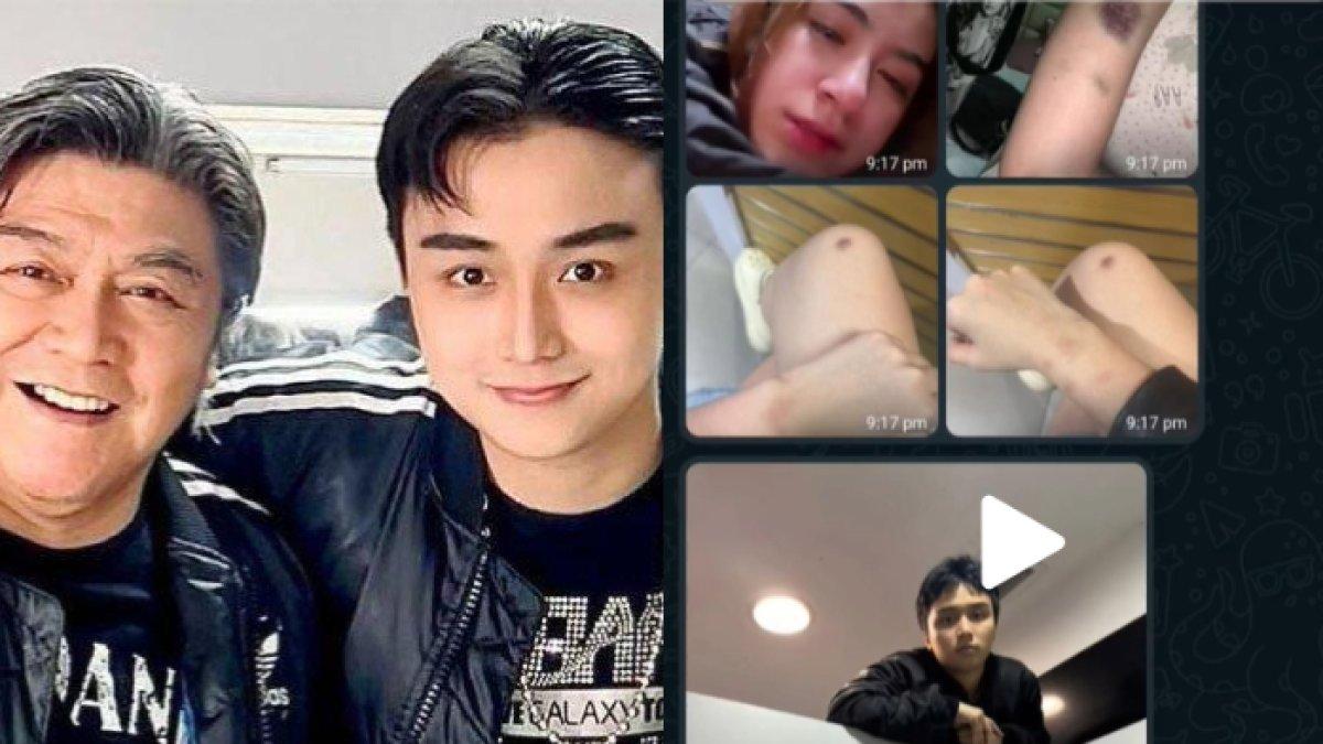 Leon Dozan anak Willy Dozan diduga aniaya sang kekasih, Rinoa Aurora