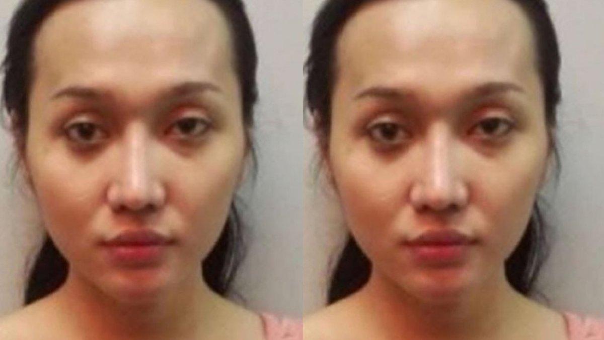 Lucinta Luna mulai jalani oplas