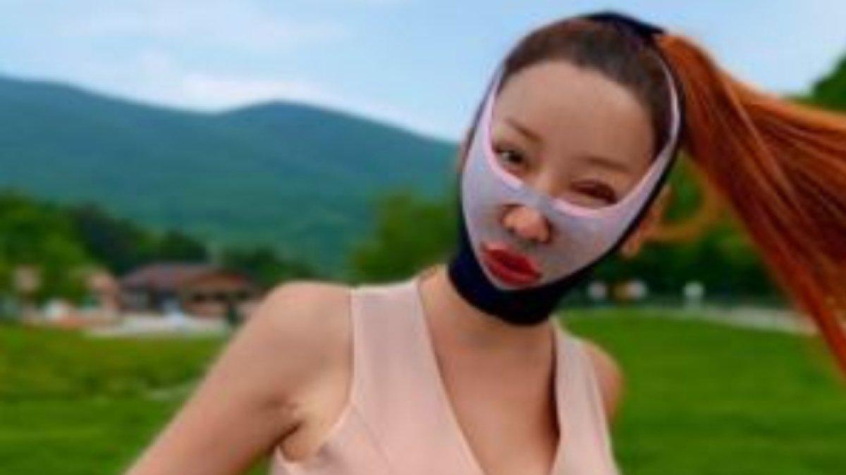 Lucinta Luna operasi plastik di Korea Selatan