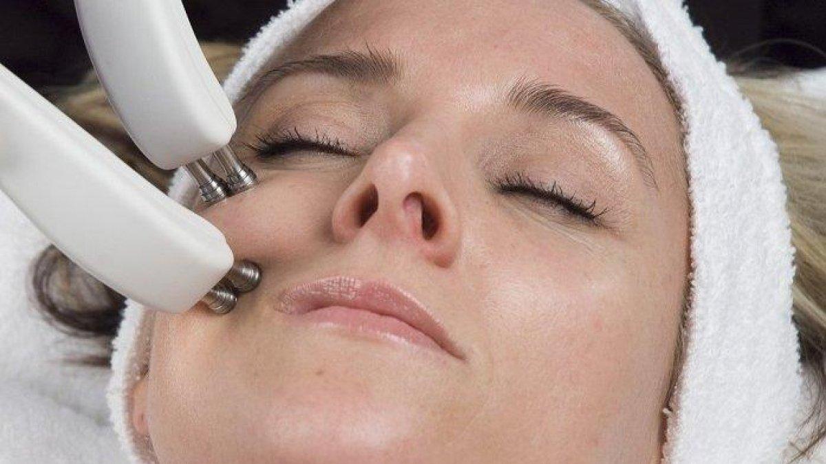 Microneedling untuk mengobati keriput