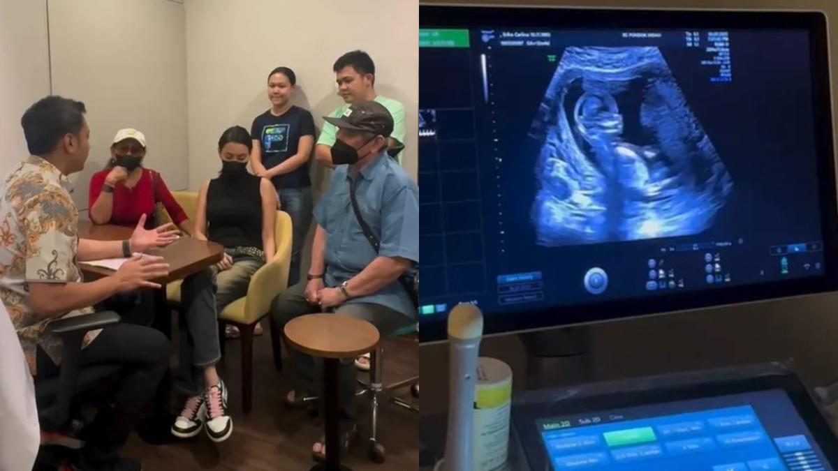 Momen Erika Carlina jalani pemeriksaan USG ditemani keluarga.