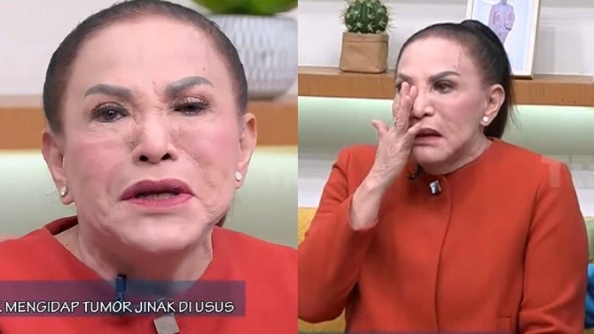 Mpok Atiek mengaku divonis mengidap tumor di ususnya.