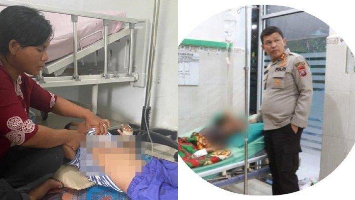 NASIB pilu bocah yatim di Sumatera Utara dianiaya tantenya dengan setrika panas hanya gara-gara habiskan rambutan.