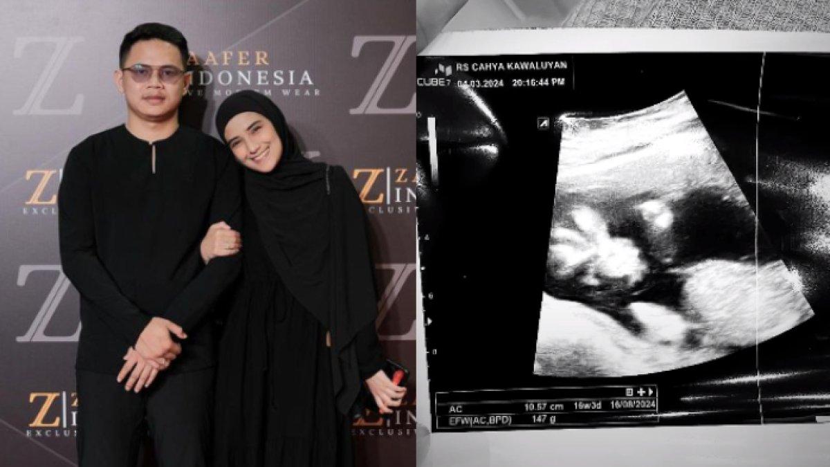Nadya Mustika mengumumkan kehamilannya.