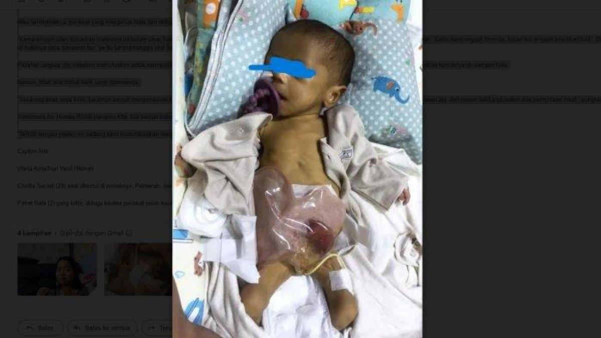 Nala, bayi 2 bulan berjuang menghadapi fase kritisnya di NICU RSAB Harapan Kita, Jakarta Barat karena suster lalai beri susu formula.