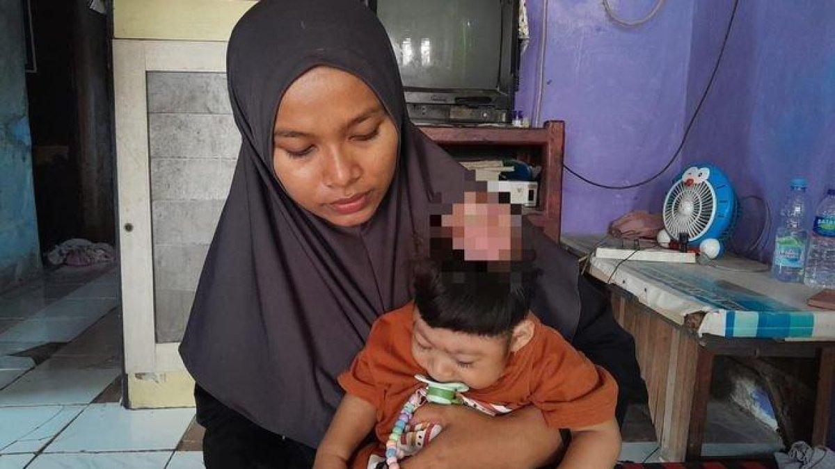 Nasib balita tanpa tempurung kepala di Subang