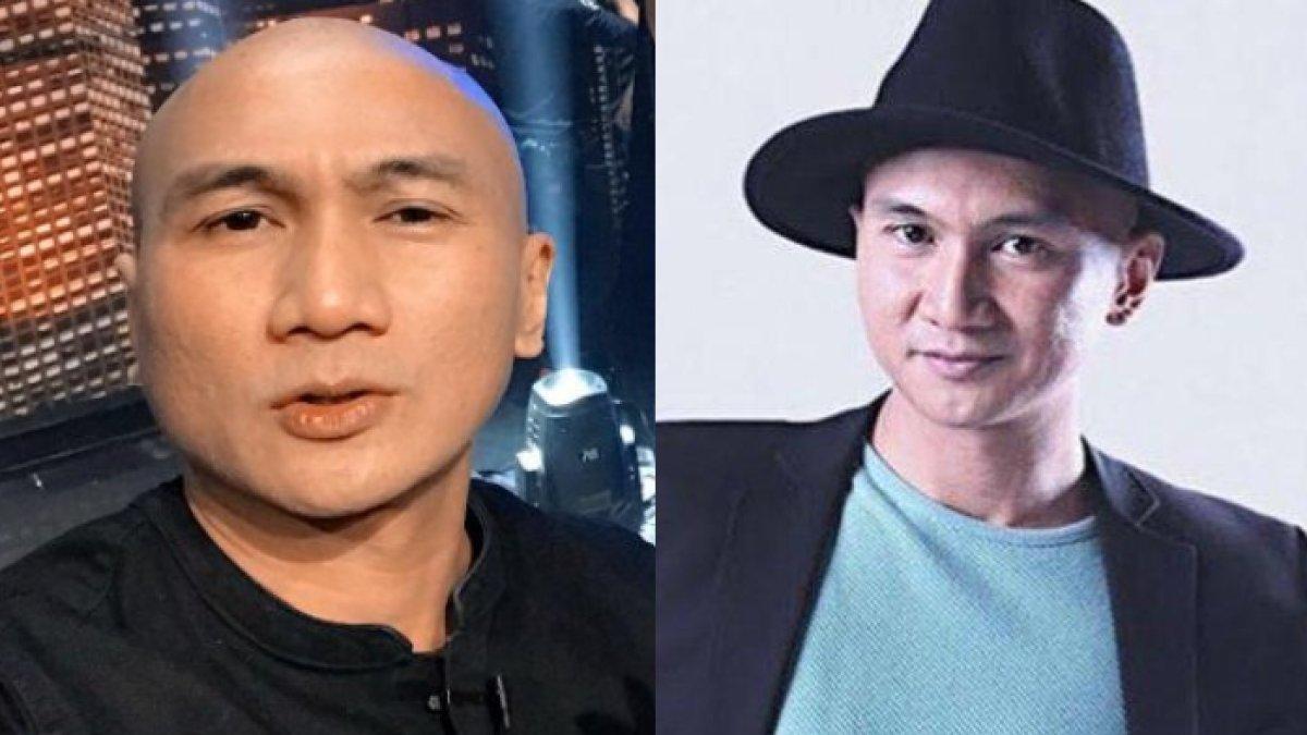 Penampilan Anji ketika botak