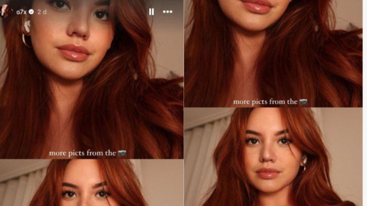 Penampilan baru Shafa Harris dengan hidung mancung