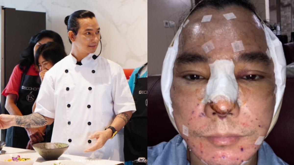 Penampilan terkini Eddy Siswanto