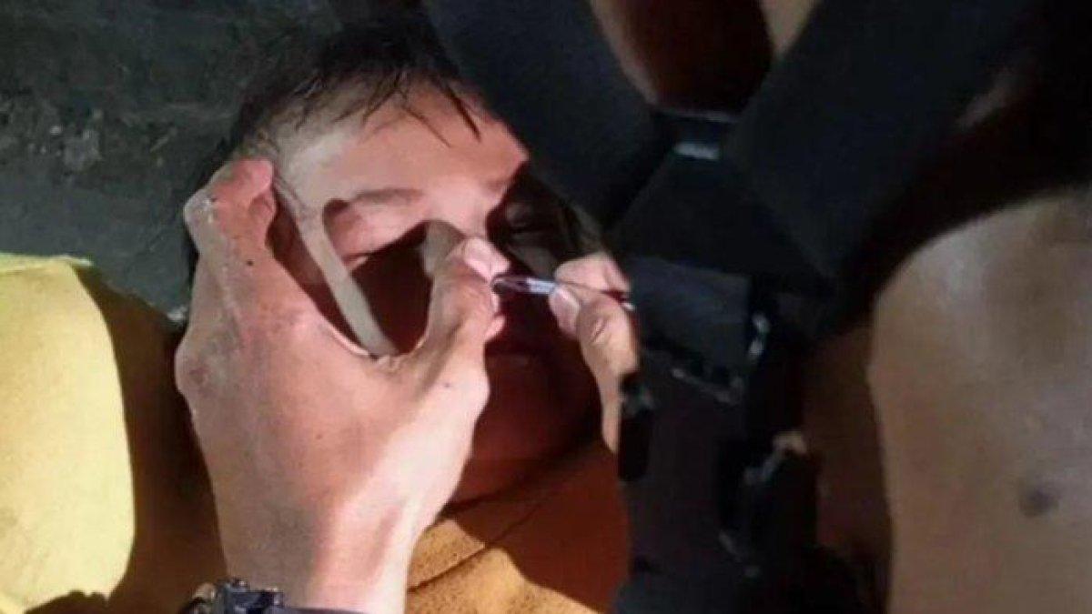 Petugas rescue Damkar Kota Bekasi melakukan evakuasi pada balita yang hidungnya kemasukan tutup pulpen