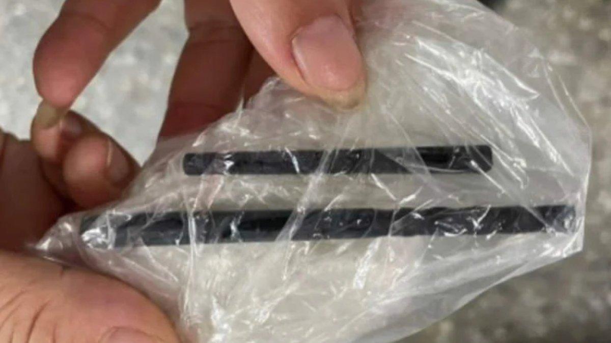 Pria di Vietnam sakit kepala, ternyata ada sumpit menancap di tengkoraknya.