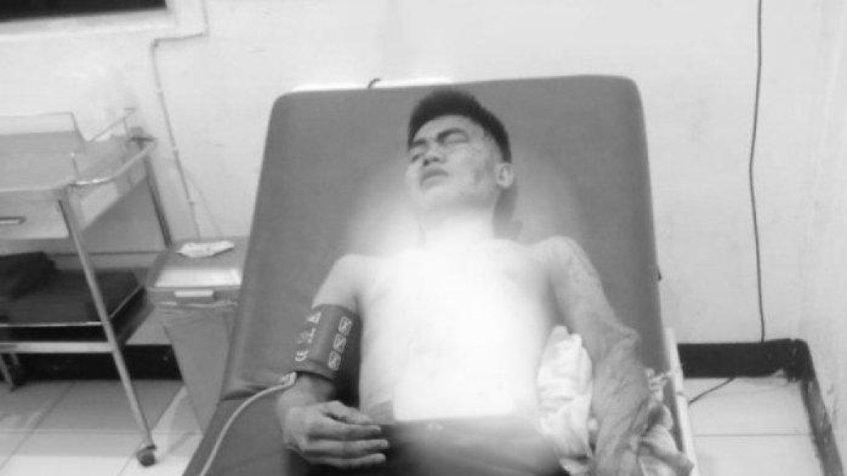 Restu (19) warga Desa durian Seginim, Bengkulu Selatan menjadi korban pembacokan orang tidak dikenal, Senin (9/10/2023)