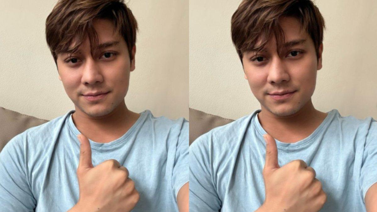 Rizky Billar berangsur membaik