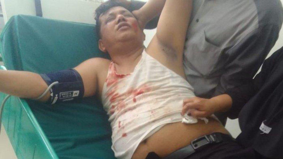 Ruslan, Kepala Desa Sindangjaya, Kabupaten Bekasi, terluka parah di kepala karena tertimpa baliho caleg yang ambruk.