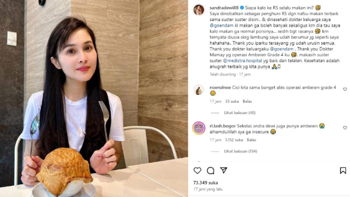 Sandra Dewi menderita ambeien grade 4