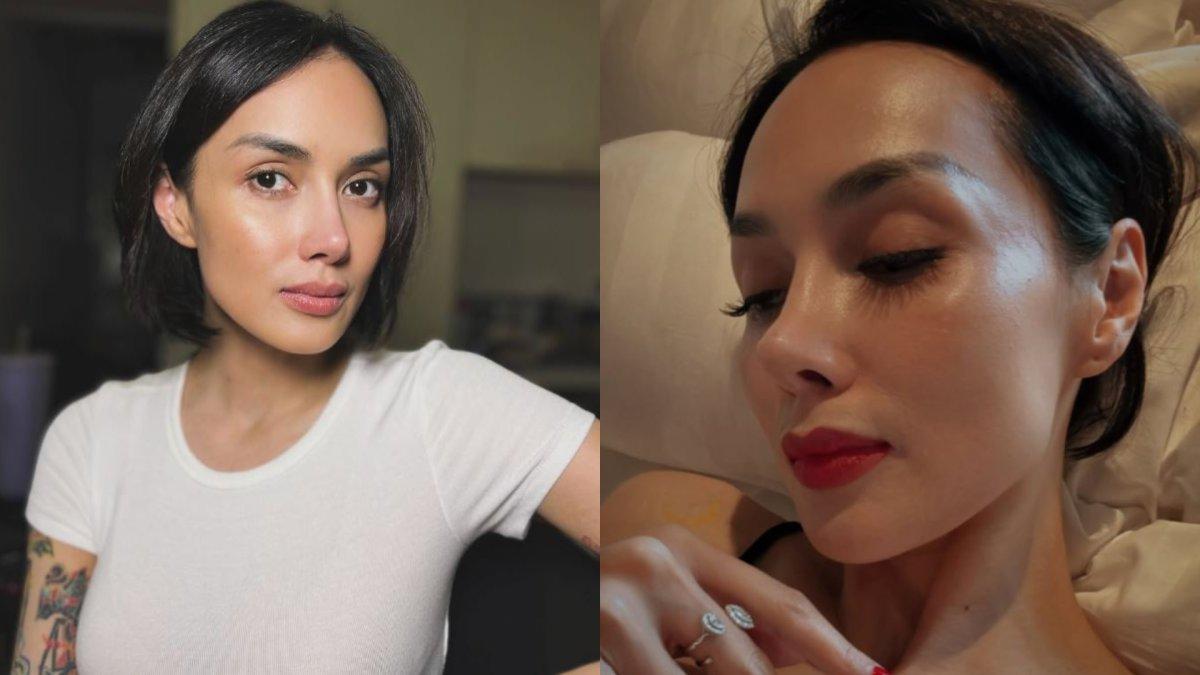 Sara Wijayanto disebut sempat menjalani prosedur kecil pada bagian hidungnya.