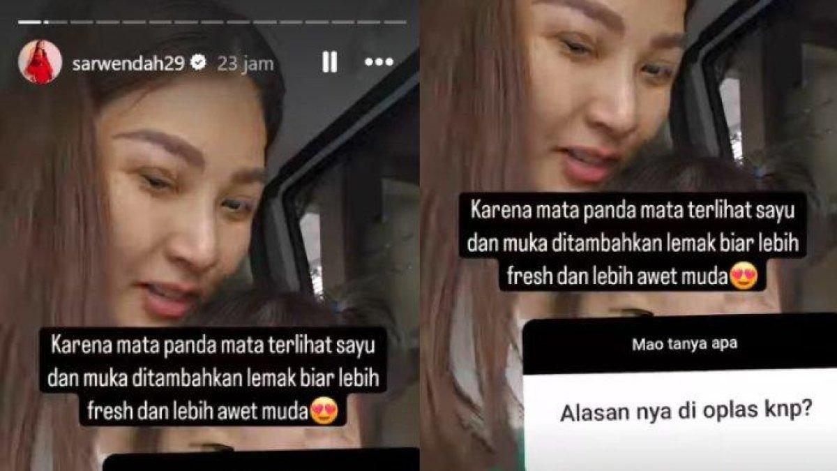 Sarwendah beber alasan oplas