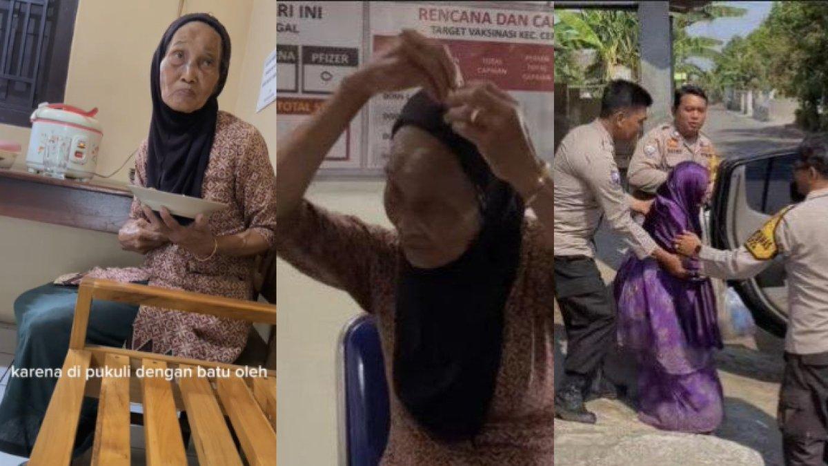 Seorang ibu sabar 12 tahun merawat anaknya yang alami gangguan jiwa meski sering terima perlakuan kasar hingga wajah lebam