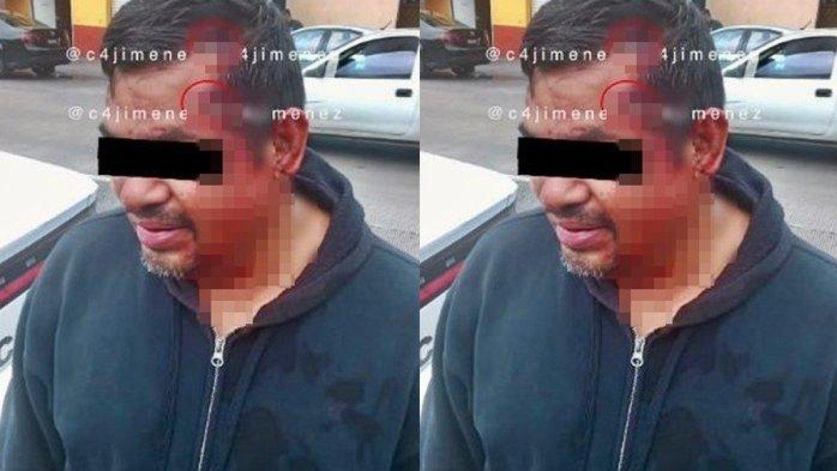 Seorang pria asal Meksiko berhasil selamat usai ditembak dua kali di bagian kepala. Bahkan, peluru yang ditembakkan terpantul dan hanya menyisakan luka kecil di kepala.