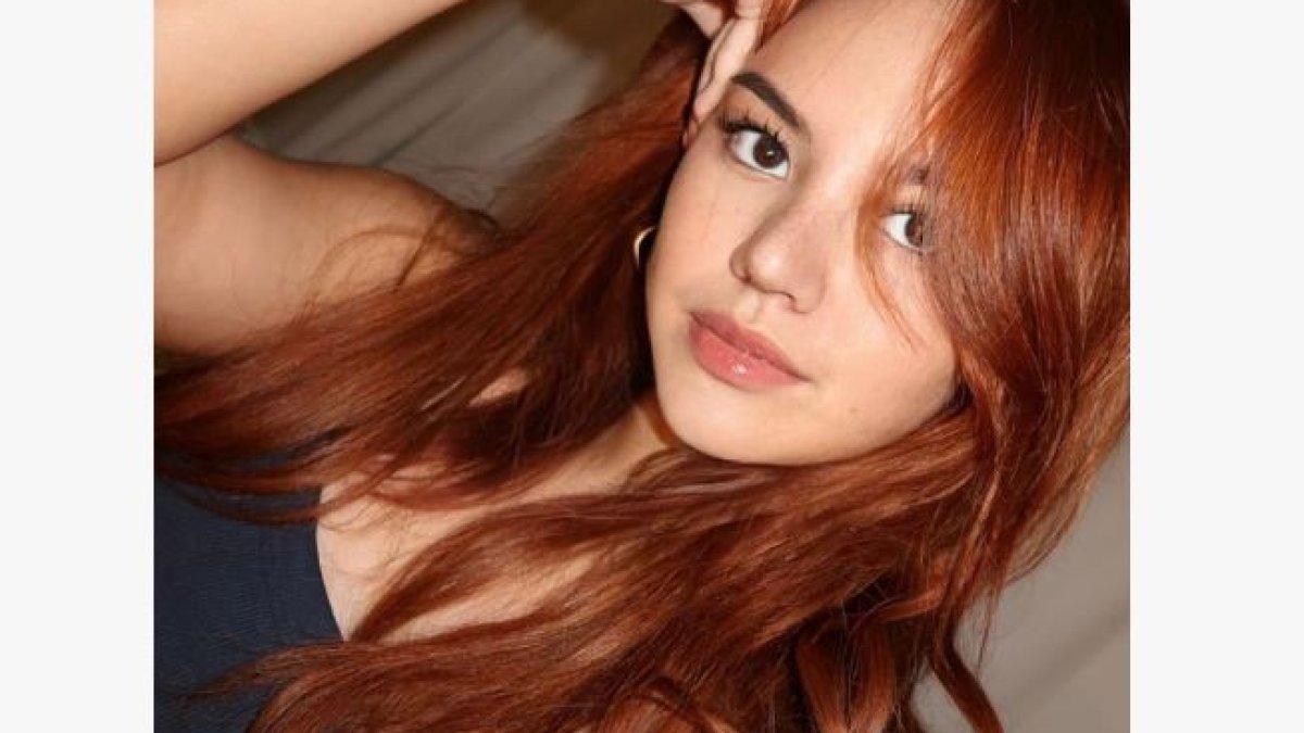 Shafa Harris mengaku sudah pernah menjajal filler untuk hidungnya.