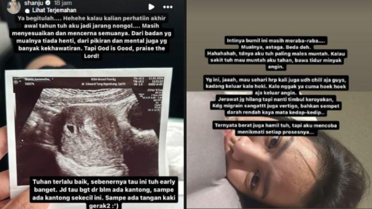 Shanju mengaku sempat mengalami mental breakdown