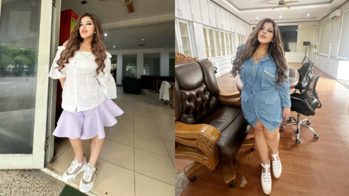 Shindy Samuel tampil lebih kurus dibanding sebelum operasi