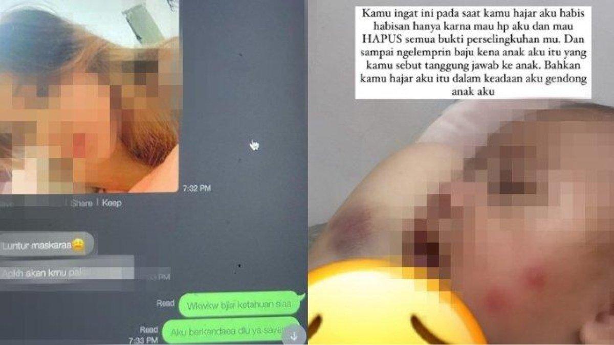 Tak hanya dikhianati, Angga juga pernah melakukan KDRT kepada Kurniah.