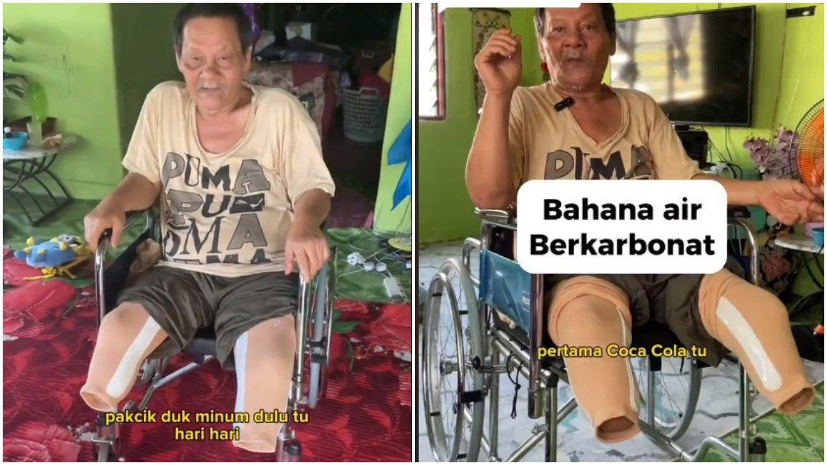 Terlalu hobi minum minuman bersoda, pria ini kini harus menyesal karena kedua kaki diamputasi.