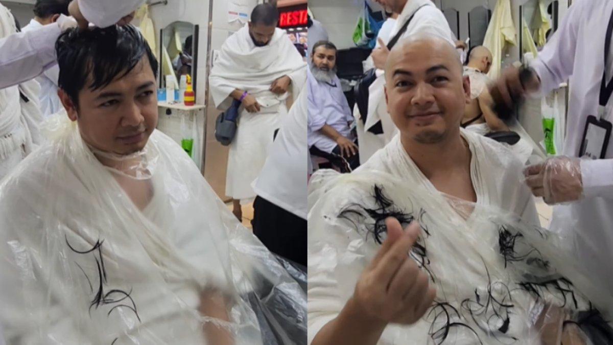 Tommy Kurniawan kini botak