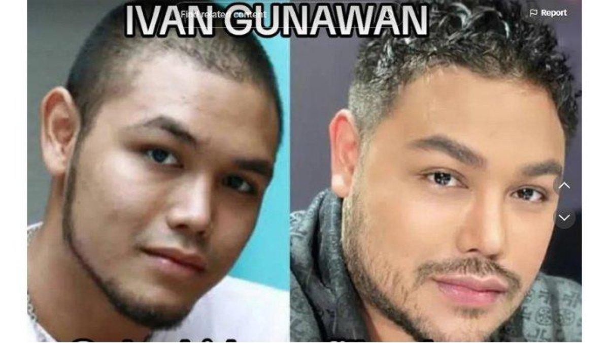 Transformasi wajah Ivan Gunawan dulu (kiri) dan sekarang (kanan)
