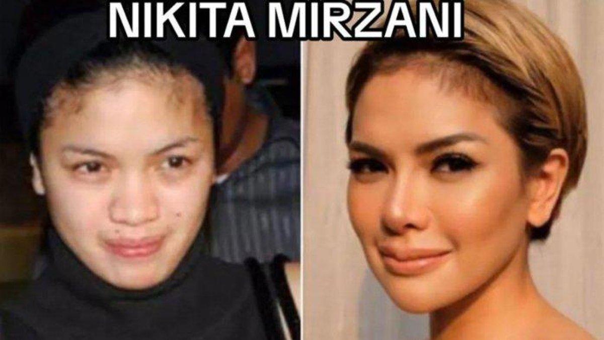 Transformasi wajah Nikita Mirzani dulu (kiri) dan sekarang (kanan)