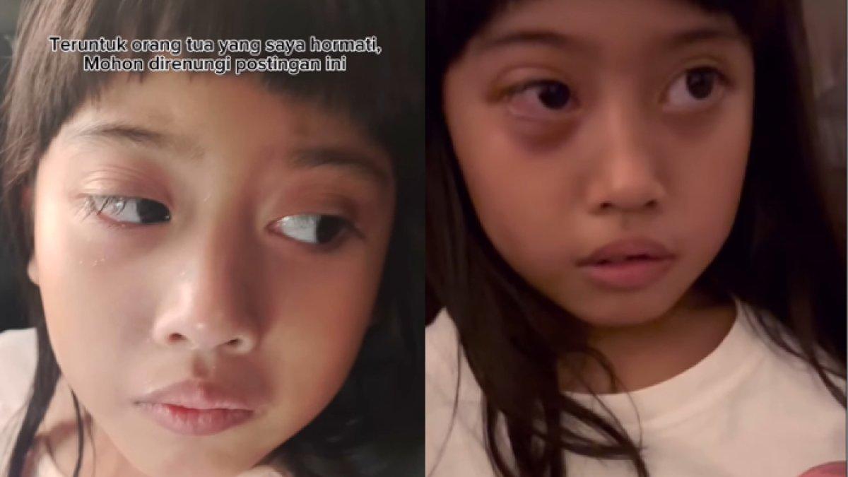 Vania Athabina dilempar batu teman sekolah