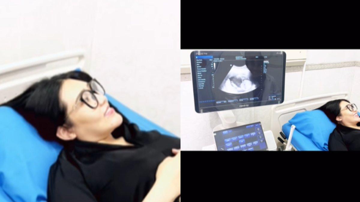 Via menjalani USG untuk mengetahui kondisi sang jabang bayi