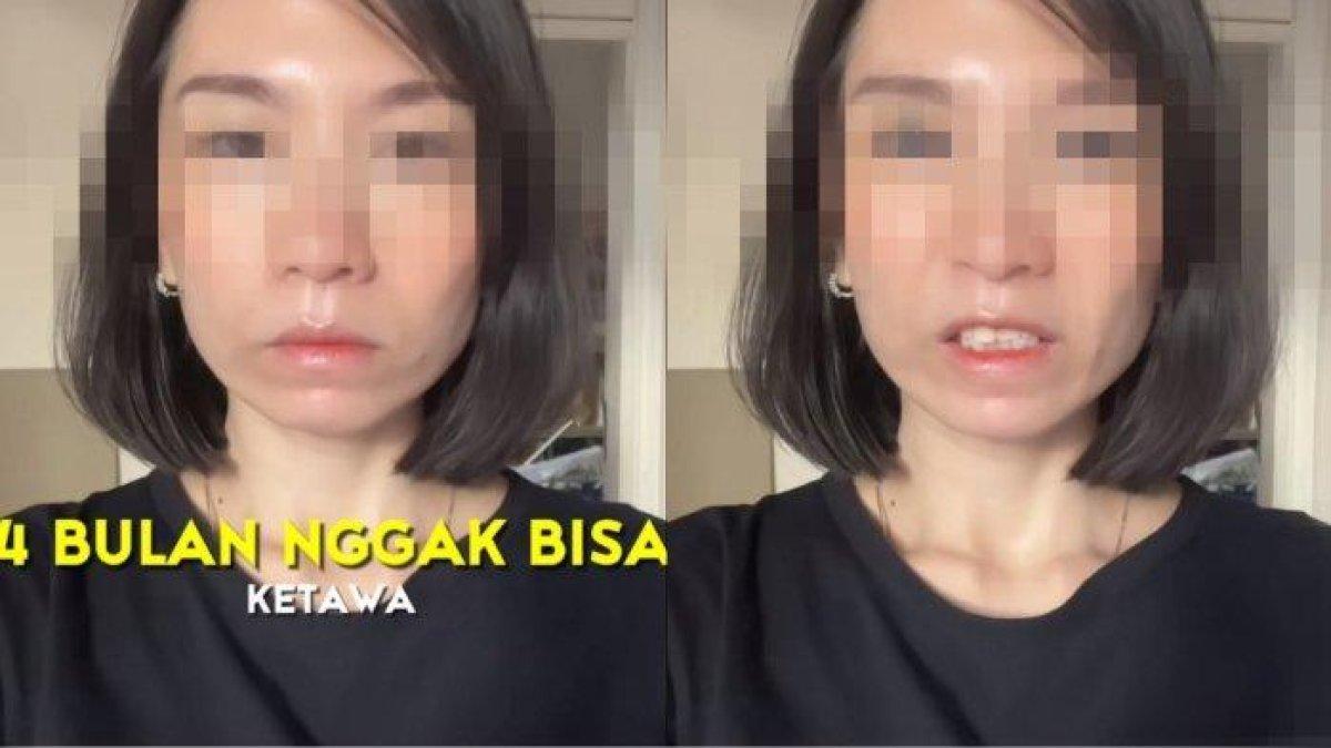 Viral curhat wanita tak bisa tertawa selama empat bulan setelah melakukan suntik botox. Curhatan itu diunggah oleh akun TikTok @evelineaprilisa.