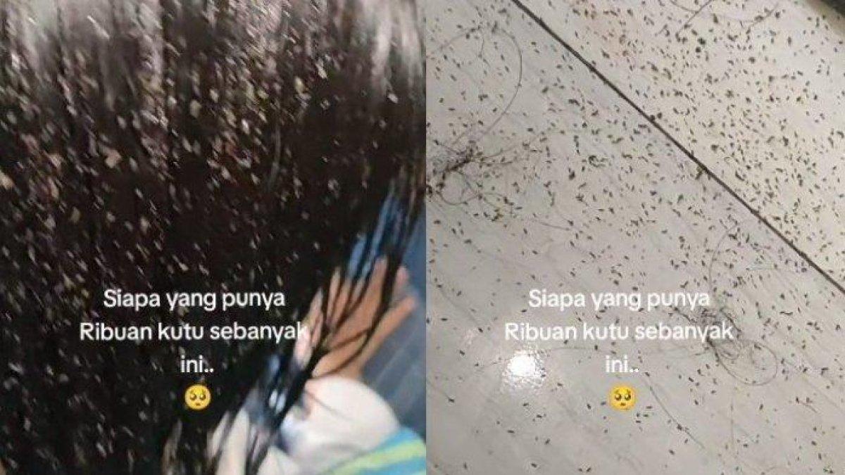 Viral penampakan rambut seorang bocah di Trenggalek, Jawa Timur penuh dengan kutu.