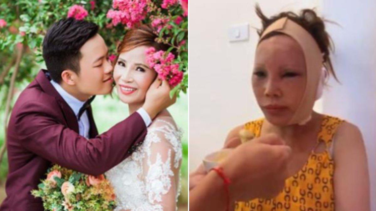 Wanita 62 tahun nikahi pria 26 tahun, kini operasi plastik biar awet cantik.