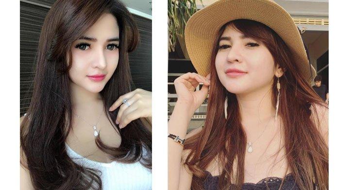 Deretan Foto Transformasi Penampilan Aldira Chena, Jadi Saksi Kasus