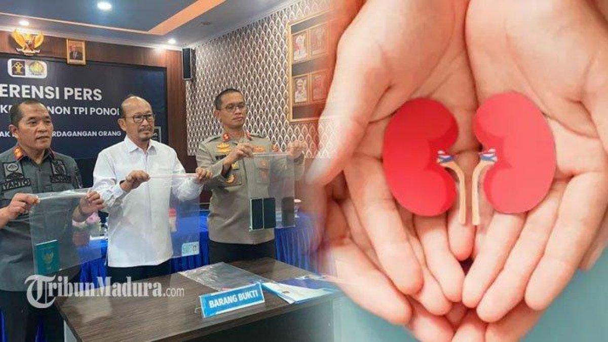 Ketua kantor Imigrasi Kelas II Non TPI Ponorogo, Yanto (kiri), Kadiv Keimigrasian Kanwil Kemenkumham Jatim, Hendro Tri Prasetyo (tengah) dan Kapolres Ponorogo (kanan) menunjukkan barang bukti kasus perdagangan ginjal internasional