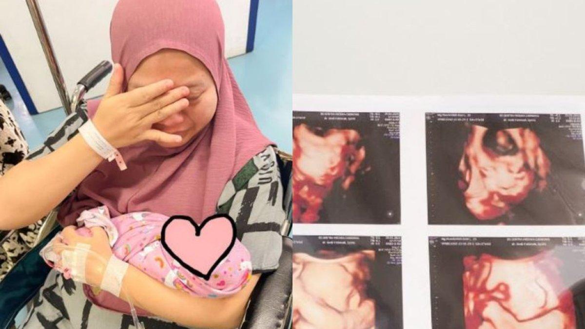 Inilah profil dan akun medsos Musdalifah Basri komika ini beberkan perjuangan anak kembarnya saat di ruang NICU