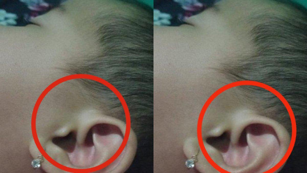 Bayi di Subang miliki telinga mirip lafadz Allah