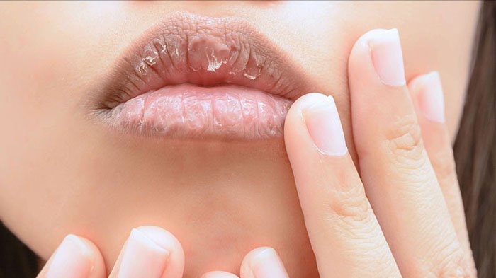 Vitamin B misalnya, dapat membantu mengatasi bibir kering dan pecah-pecah akibat paparan sinar matahari.