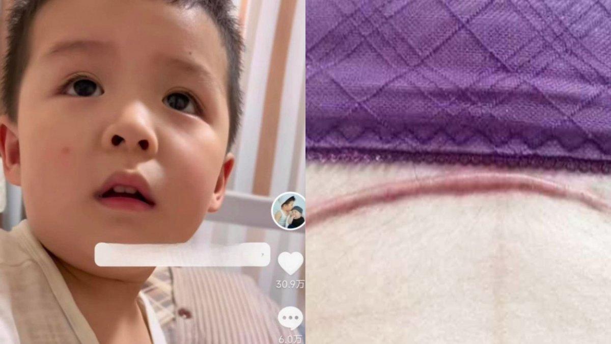 Bocah 3 tahun nangis lihat bekas luka caesar di perut ibunya