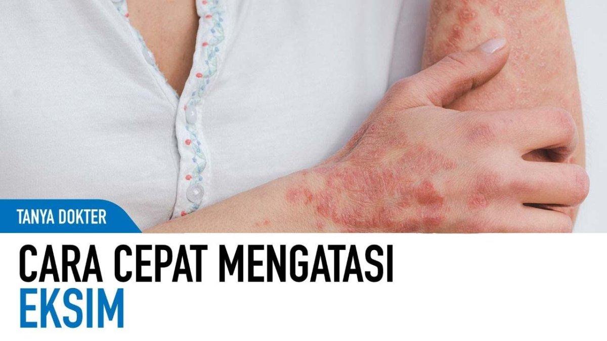 5 Cara Mengobati Dermatitis Dengan Bahan Alami Lidah Buaya, Minyak