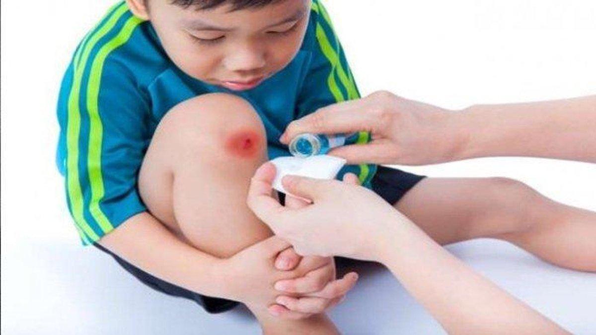 bersihkan luka untuk mengobati gigitan kucing