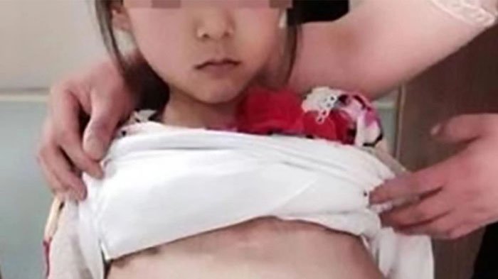 Bocah yang dicabuli ayah di Subang hamil 5 bulan